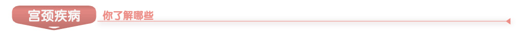 宫颈疾病了解哪些